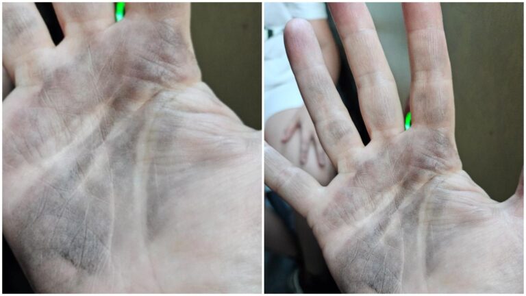 O bucureșteancă a avut parte de o surpriză neplăcută cu troleibuzul 86: mânerul scaunului era extrem de murdar