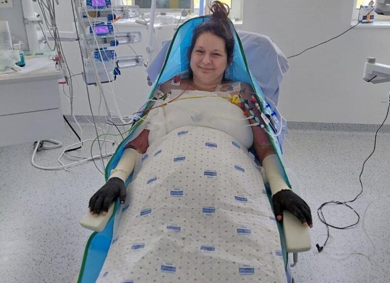 Starea Laviniei, pacienta cu arsuri transferată în Belgia, se îmbunătățește ușor