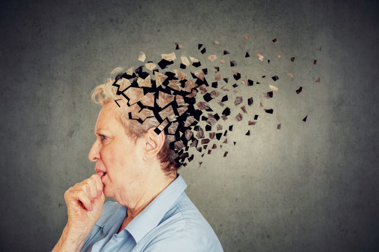 Studiu șocant: Alzheimer evoluează de 20 de ori mai rapid la femei