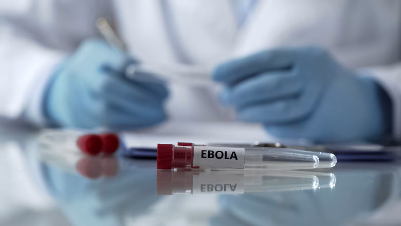 Ebola lovește medicii: 75 infectați, 17 morți în Congo - Politica